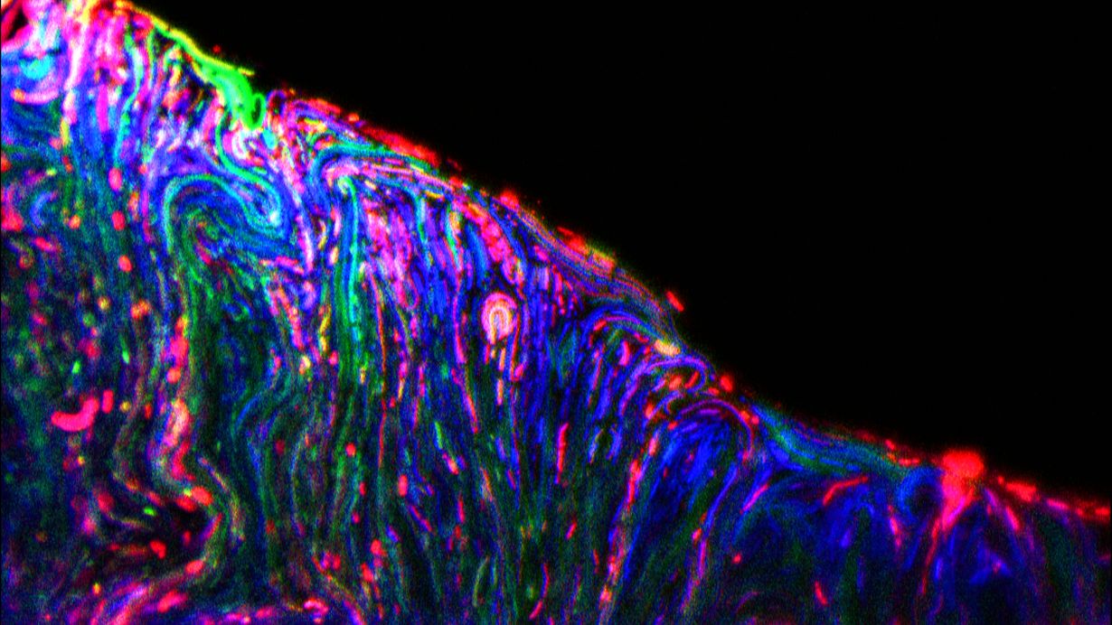 Microorganisms feel at ease in biofilms. In the microscope image, they are marked in different colors.