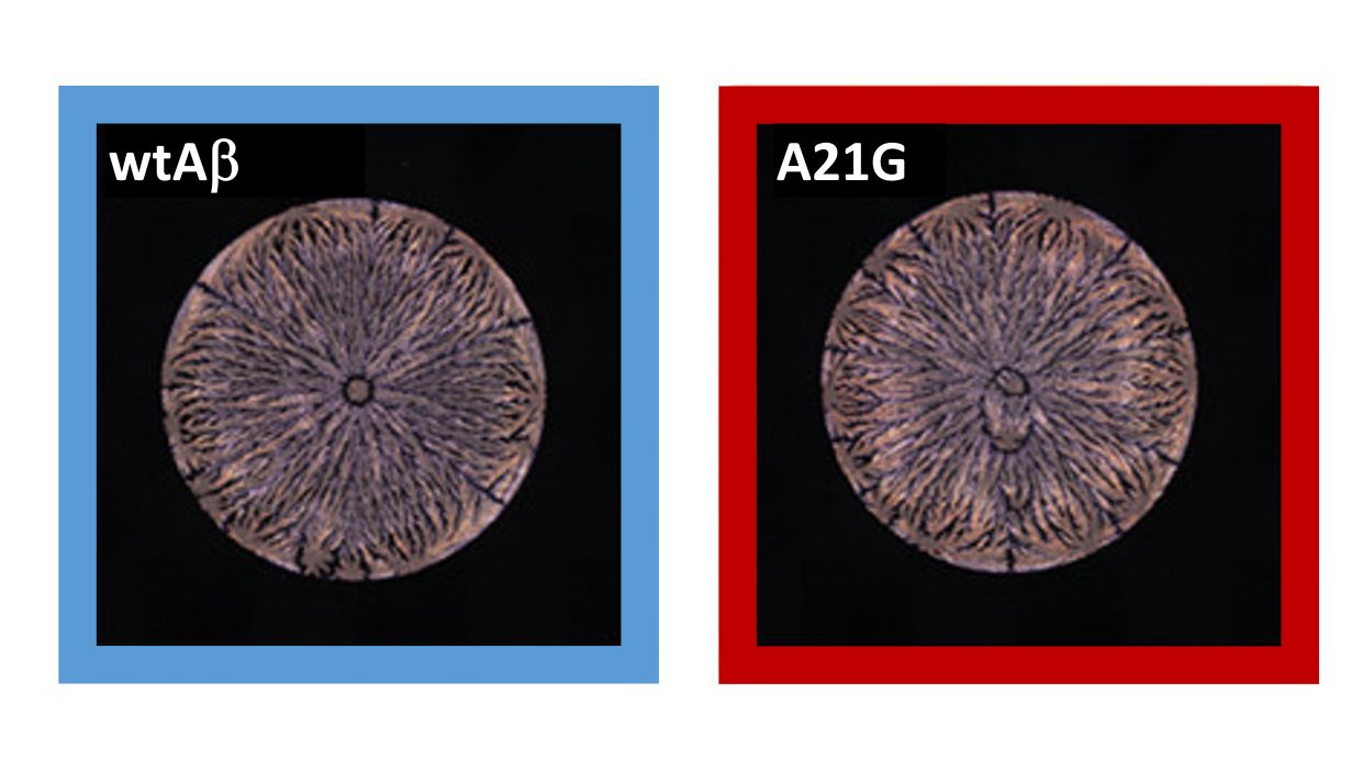 Biochemistry: "Fingerprinting" of peptides allows earlier detection of Alzheimer's